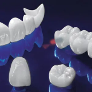 Các loại răng sứ